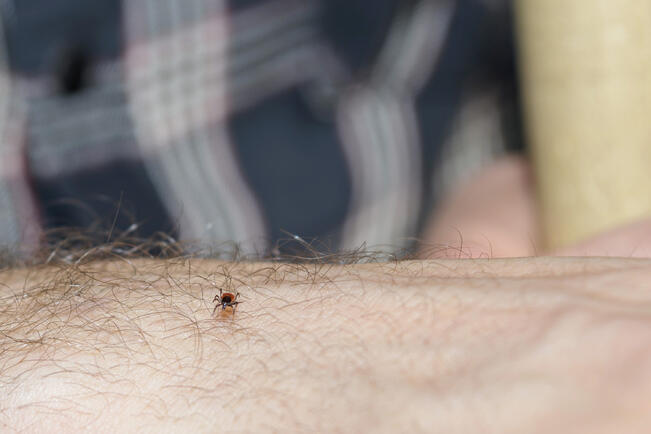 THL on julkaissut ohjeen, miten toimia punkin kiinnittyessä iholle.