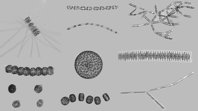 Kollaasi planktonkameran tuottamista mikroskooppisista lajikuvista. Planktonkamera kuvaa pysäytyskuvia planktonlevistä jatkuvana, noin sekunnin välein vaihtuvana kuvavirtana. 