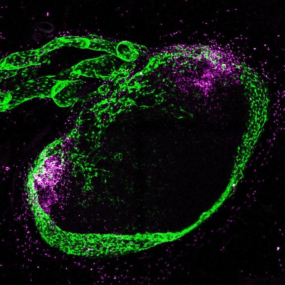 Kuvan imusolmuke (noin 2 mm kokoinen) on altistunut rokotteelle. Vihreät solut ovat imusolmukkeen onteloita verhoavia rakennesoluja. Vasemmalla ylhäällä näkyvät imusolmukkeen putkimaiset imusuonet. Pinkit pisteet ovat eosinofiilisia valkosoluja, joita on kerääntynyt ryppäiksi imusolmukkeen sisälle. Valkosoluja on myös imusolmukkeen ympärillä rasvakudoksessa. 