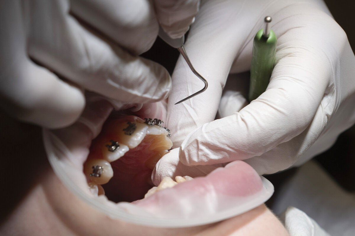 Moni ihminen kertoo Varhan lähettäneen asiakkaille aiheettomia laskuja suun terveydenhuollon käynneistä. Aiheettomia laskuja on maksettu perinnän pelossa.