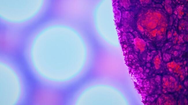 Kun hiukkasten koko putoaa alle muutaman sadan nanometrin, niiden käyttäytymistä alkaa hallita diffuusio eli hiukkasten satunnainen liike. Tällöin niihin kohdistuvat ohjaavat voimat heikkenevät ja erotustarkkuus romahtaa.