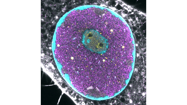 Parvovirus infektoituneen tumajyväsen laajennettu mikroskooppikuva (TREx Expansion microscopy). Kuvassa näkyvät kromatiinin (syaani), virusproteiinin (magenta), tumajyväsen fibrillariinin (keltainen) sekä totaali proteiini (harmaa).
