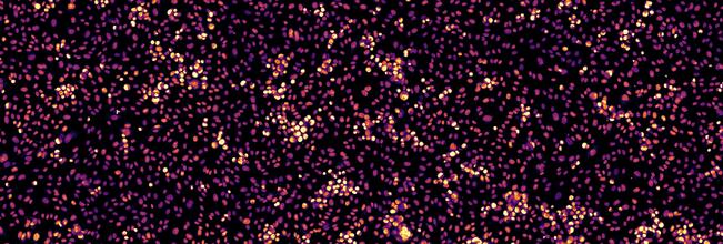 Fluoresenssimikroskooppikuva, jossa näkyvät verisuonten sisäpintaa verhoavien endoteelisolujen tumat. NucleiSky käyttää tumien sijaintia biologisena sormenjälkenä tunnistaakseen halutun näkökentän ja löytääkseen siihen takaisin. 

